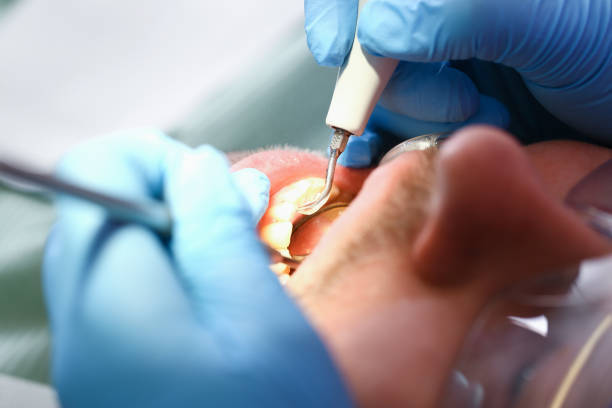 Best Emergency Dentist Near Me  in Johnson City, KS