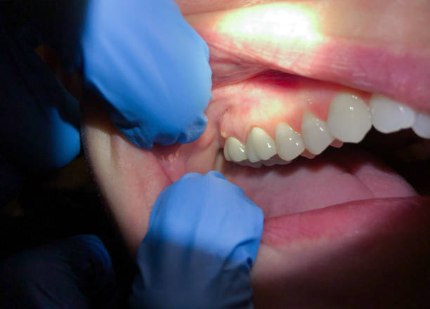 Best Tooth Pain Emergency Relief  in Johnson City, KS