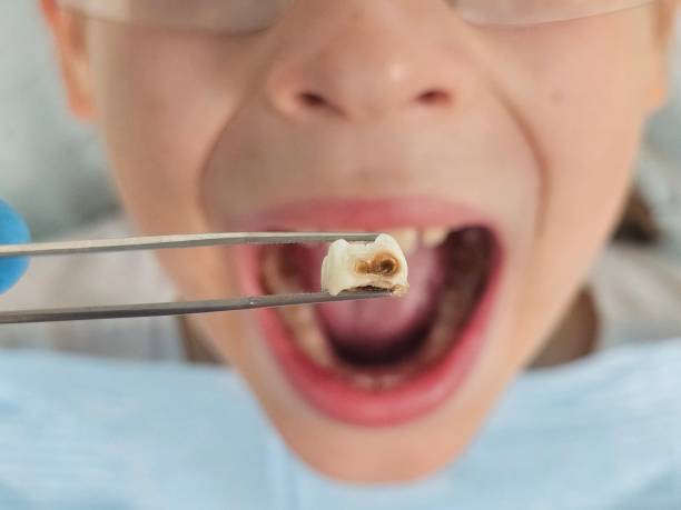  Johnson City, KS Emergency Dentist Pros
